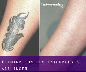 Élimination des tatouages à Aislingen