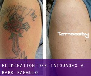 Élimination des tatouages à Babo-Pangulo