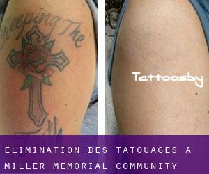 Élimination des tatouages à Miller Memorial Community