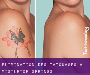 Élimination des tatouages à Mistletoe Springs