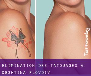 Élimination des tatouages à Obshtina Plovdiv