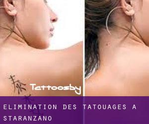 Élimination des tatouages à Staranzano